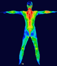 thermography, thermal imaging, diagnostics, thermal radiation