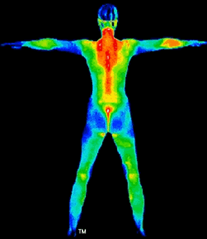 thermography, thermal imaging, diagnostics, thermal radiation